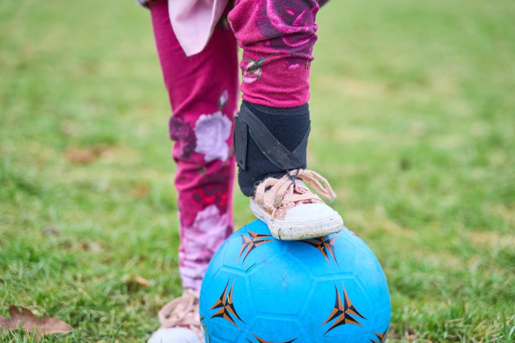 Child using the OrthoPed splint while playing football